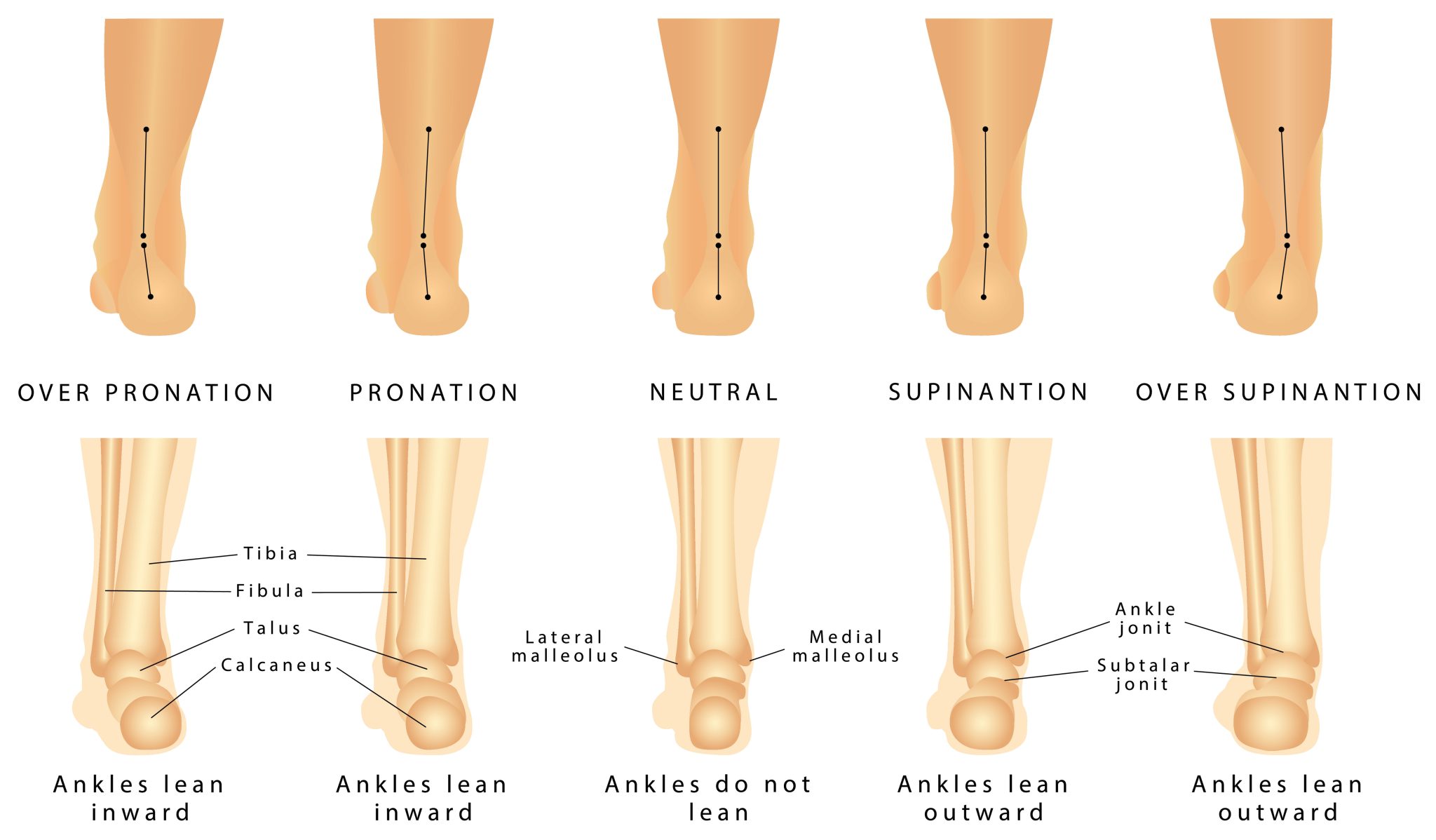 Sudden Ankle Pain Without Injury - Rehab 49